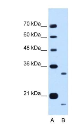 CPR8 Antibody, Novus Biologicals 100 &mu;L | Buy Online | Novus Biologicals | Fisher Scientific