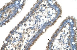 CPS1 Antibody, Novus Biologicals 0.1mg; Unlabeled:Antibodies, Polyclonal
