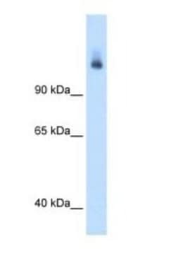 CPS1 Antibody, Novus Biologicals 0.1mg; Unlabeled:Antibodies, Polyclonal