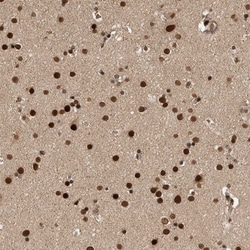 CPSF2 Antibody, Novus Biologicals 25 &mu;L; Unlabeled:Antibodies, Polyclonal