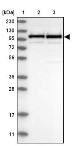 CPSF2 Antibody, Novus Biologicals 25 &mu;L; Unlabeled:Antibodies, Polyclonal