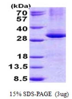 Novus Biologicals&trade;&nbsp;Recombinant Human CPSF4 His Protein