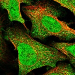 CPSF4L Antibody, Novus Biologicals 0.1mL; Unlabeled:Antibodies, Polyclonal