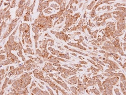 CPT1A Antibody, Novus Biologicals 0.1mL; Unlabeled:Antibodies, Polyclonal