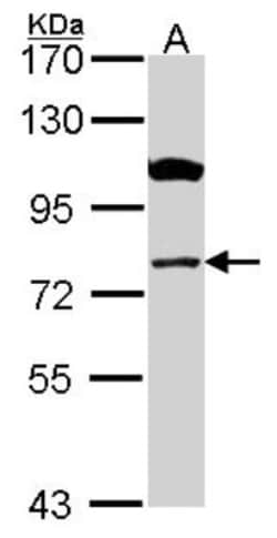 CPT1A Antibody, Novus Biologicals 0.1mL; Unlabeled:Antibodies, Polyclonal