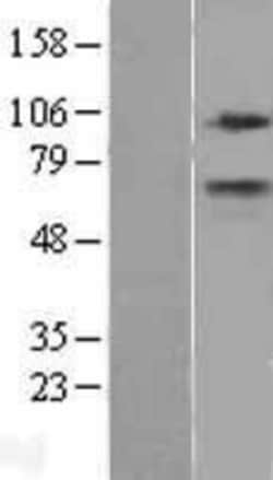 Novus Biologicals&trade;&nbsp;CPT1A Overexpression Lysate