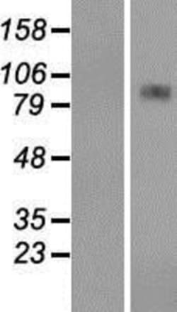 Novus Biologicals&trade;&nbsp;CPT1A Overexpression Lysate