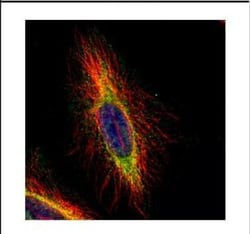 CPT1B Antibody, Novus Biologicals 0.1mL; Unlabeled:Antibodies, Polyclonal