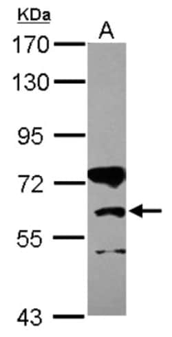CPT1B Antibody, Novus Biologicals 0.1mL; Unlabeled:Antibodies, Polyclonal