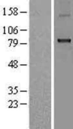 Novus Biologicals&trade;&nbsp;CPT1B Overexpression Lysate