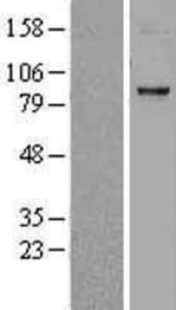 Novus Biologicals&trade;&nbsp;CPT1C Overexpression Lysate