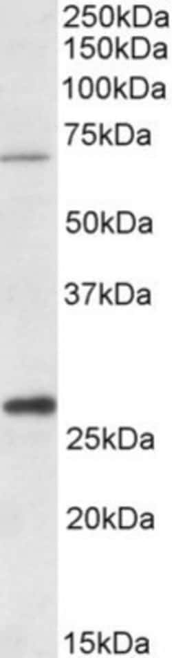 CPT2 Antibody, Novus Biologicals 0.1mg; Unlabeled:Antibodies, Polyclonal