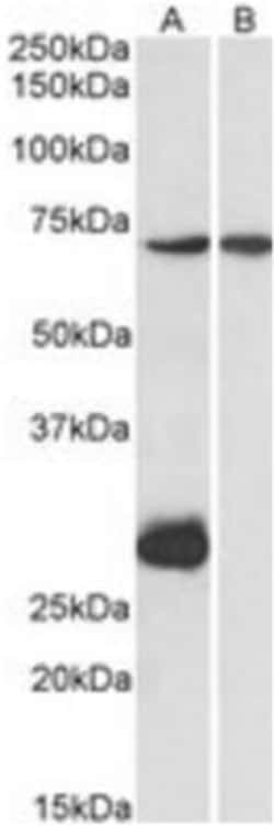 CPT2 Antibody, Novus Biologicals 0.1mg; Unlabeled:Antibodies, Polyclonal