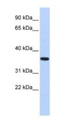 CPXCR1 Antibody, Novus Biologicals 100&mu;L; Unlabeled:Antibodies, Polyclonal