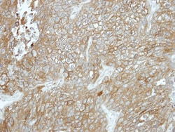 Carboxypeptidase X1/CPXM1 Antibody, Novus Biologicals 0.1mL; Unlabeled:Antibodies,