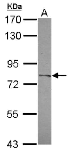 CPXM2 Antibody, Novus Biologicals 0.1mL; Unlabeled:Antibodies, Polyclonal