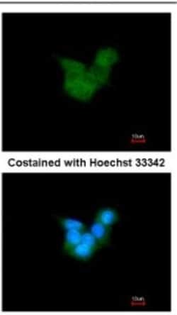 CRALBP Antibody, Novus Biologicals 0.1mL; Unlabeled:Antibodies, Polyclonal