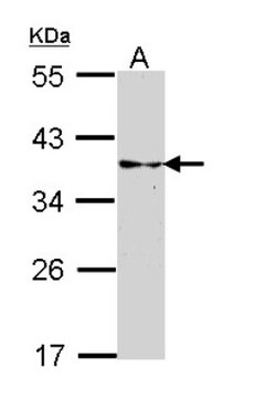 CRALBP Antibody, Novus Biologicals 0.1mL; Unlabeled:Antibodies, Polyclonal
