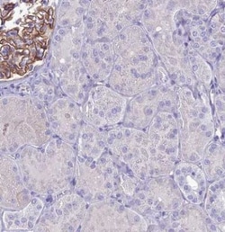 CRB2 Antibody, Novus Biologicals 25 &mu;L, Unconjugated:Antibodies, Polyclonal