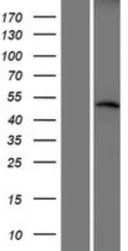 Novus Biologicals&trade;&nbsp;CRBN Overexpression Lysate