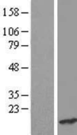 Novus Biologicals™ CRCP Overexpression Lysate
