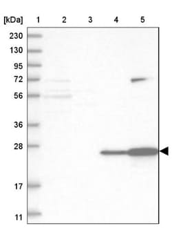 C-Reactive Protein/CRP Antibody, Novus Biologicals:Antibodies:Primary Antibodies