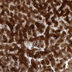 C-Reactive Protein/CRP Antibody, Novus Biologicals:Antibodies:Primary Antibodies