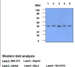 C-Reactive Protein/CRP Antibody (5A9) - BSA Free, Novus Biologicals 0.1mL;