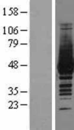 Novus Biologicals&trade;&nbsp;Creatine Kinase, Muscle/CKMM Overexpression Lysate