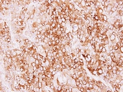 Creatine kinase MT 1A Antibody, Novus Biologicals 0.1mL; Unlabeled:Antibodies,