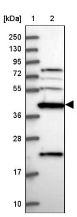 Creatine kinase MT 1A Antibody, Novus Biologicals:Antibodies:Primary Antibodies
