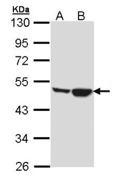 Creatine kinase MT 1A Antibody, Novus Biologicals 0.1mL; Unlabeled:Antibodies,