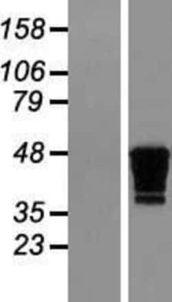 Novus Biologicals&trade;&nbsp;Creatine kinase MT 1B Overexpression Lysate
