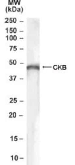 Creatine Kinase BB Antibody, Novus Biologicals 0.1 mg | Buy Online | Novus Biologicals | Fisher Scientific