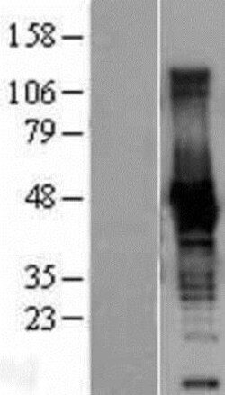 Novus Biologicals&trade;&nbsp;Creatine Kinase BB Overexpression Lysate