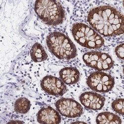 Creatine kinase MT 1A Antibody, Novus Biologicals:Antibodies:Primary Antibodies