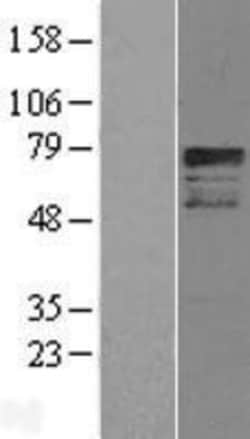 Novus Biologicals&trade;&nbsp;OASIS/CREB3L1 Overexpression Lysate