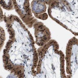 CREB3L2 Antibody, Novus Biologicals 0.1mL; Unlabeled:Antibodies, Polyclonal