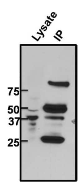 CREB Antibody (LB9), Novus Biologicals 0.1mg; Unlabeled:Antibodies, Monoclonal