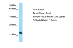 CREG Antibody, Novus Biologicals 100 &mu;L | Buy Online | Novus Biologicals | Fisher Scientific