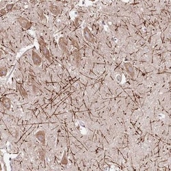 PPIL2 Antibody, Novus Biologicals:Antibodies:Primary Antibodies