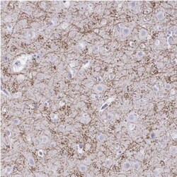 PPIL2 Antibody, Novus Biologicals:Antibodies:Primary Antibodies