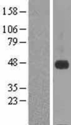 Novus Biologicals&trade;&nbsp;CRELD1 Overexpression Lysate