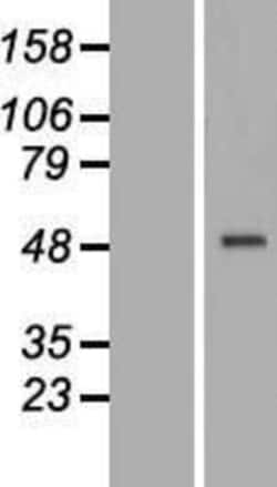 Novus Biologicals&trade;&nbsp;CRELD1 Overexpression Lysate