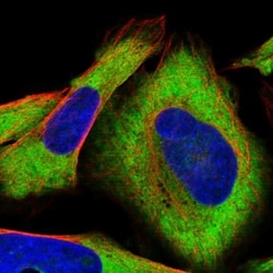 CRELD1 Antibody, Novus Biologicals 25 &mu;L | Buy Online | Novus Biologicals | Fisher Scientific