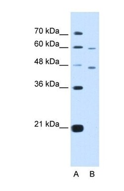CRELD1 Antibody, Novus Biologicals 0.1mg; Unlabeled:Antibodies, Polyclonal