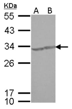 CREM Antibody, Novus Biologicals 0.1mL; Unlabeled:Antibodies, Polyclonal