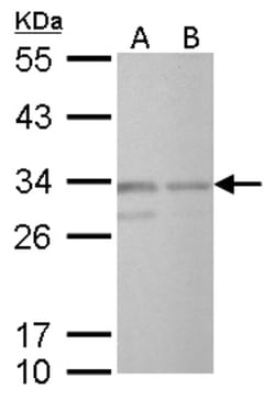 CREM Antibody, Novus Biologicals 0.1mL; Unlabeled:Antibodies, Polyclonal