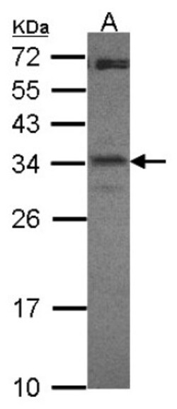 CREM Antibody, Novus Biologicals 0.1mL; Unlabeled:Antibodies, Polyclonal