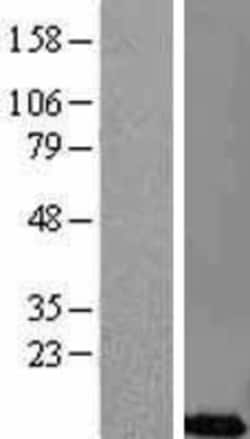 Novus Biologicals&trade;&nbsp;CREM Overexpression Lysate